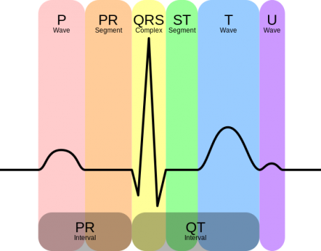 ELectrocardiogram