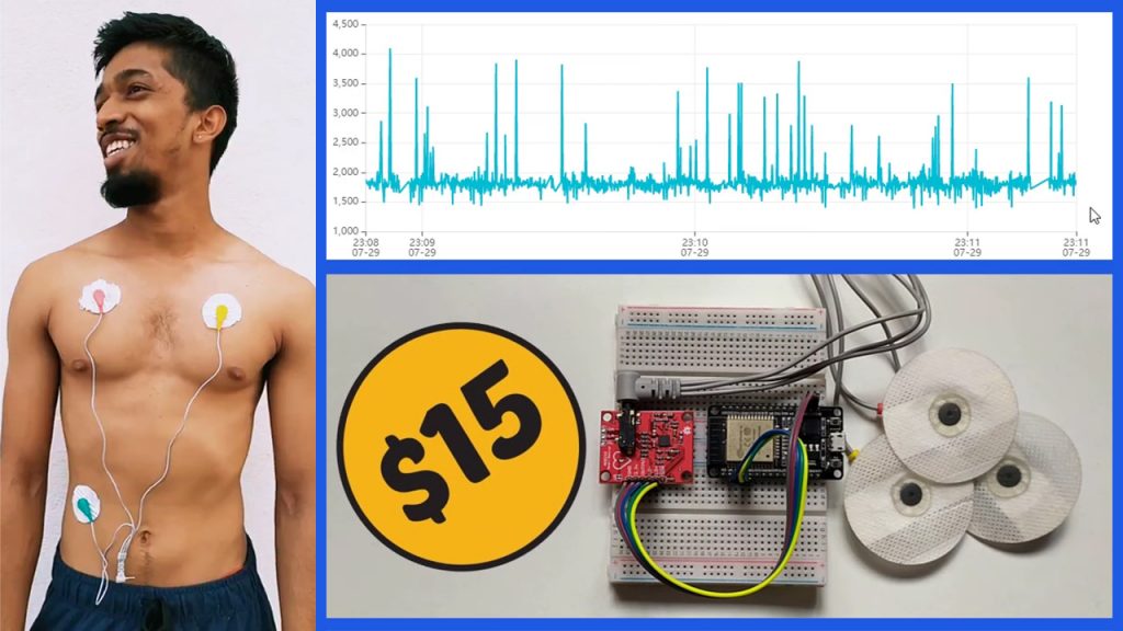 Iot Based Heart Monitoring With Esp32 Espressif Systems | Porn Sex Picture